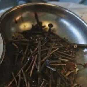 Dokter Heran, 1 Kg Baut dan Paku Ditemukan di Perut Pria Ini