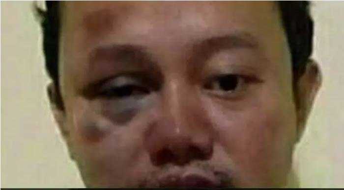 Viral wajah terdakwa pemerkosa 12 santri, Herry Wirawan, babak belur