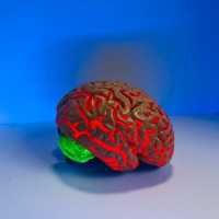 Tim Forensik Ungkap Otak Brigadir J Pindah ke Dada