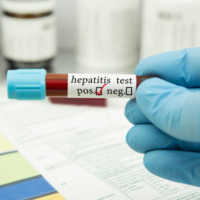 Hepatitis Akut Misterius Masuk RI, 3 Bocah Meninggal Dunia di RSCM