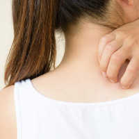 Apa Itu Jamur Ringworm: Kenali Penyebab dan Gejalanya Pada Manusia dan Hewan