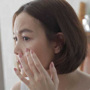 10 Cara Menghilangkan Jerawat Secara Alami dan Cepat