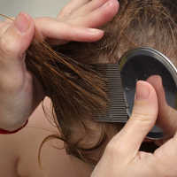 Bocah SD Ini Selalu Garuk Kepala Saat Pelajaran, Saat Disisir Gurunya, Kutunya Rontok