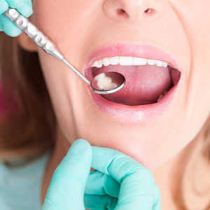 6 Manfaat Air Garam Untuk Sebagai Obat Sakit Gigi dan Mulut