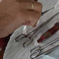 Alat Kelamin Bocah 5 Tahun DIpotong Ayahnya, Begini Kronologinya