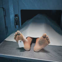 Wanita Asal Medan Tewas Usai Operasi Sedot Lemak di Depok, Polisi Datangi Klinik