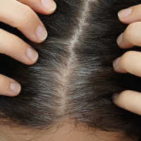 Nabi Muhammad SAW Melarang Untuk Mencabut Uban, Ini Penjelasan Medisnya