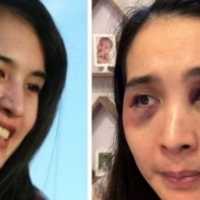 Viral Kasus KDRT Putri Balqis di Depok, Ini Fakta dan Permasalahannya