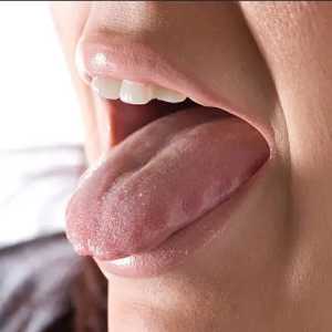 Ngeri Lidah Pria Ini berubah Warna Jadi Hijau dan Berbulu, Diduga Gegara Rokok