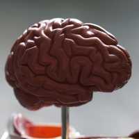 Apa Itu Mati Batang Otak? Penyakit yang Dialami Bocah di Bekasi Usai Operasi Amandel