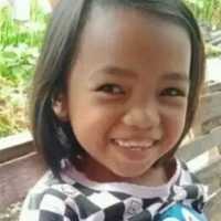 Tragis Siswi SD di Padang Pariaman: 'Dibakar' Teman, Alami Gizi Buruk, Kini Meninggal