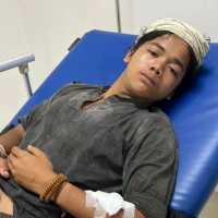 Warga Baduy Dibegal Saat Jualan Madu di Jakarta, Ditolak RS karena Tak Punya KTP