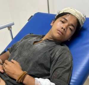 Warga Baduy Dibegal Saat Jualan Madu di Jakarta, Ditolak RS karena Tak Punya KTP